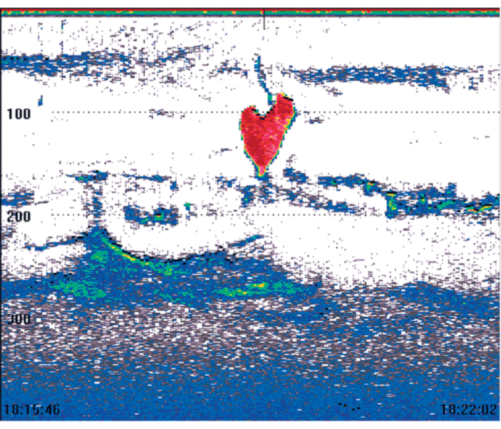 Figure 3.1 ‘Heart attack’.