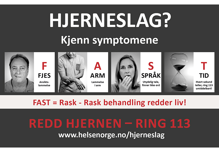 Figur 13.1 Symptomer på hjerneslag