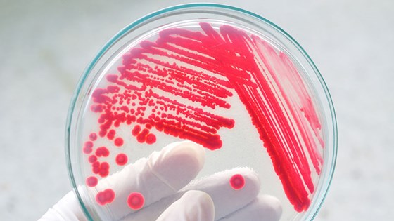Mikrobiologi laboratorietest.