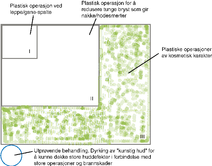 Figur 9.3 Eksempel på mulig anbefaling om prioritetsgrupper for plastisk kirurgi